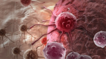 В мире стремительно растет количество заболевших раком – исследование