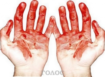 Мужчина едва не истек кровью под окнами собственного дома (ФОТО)