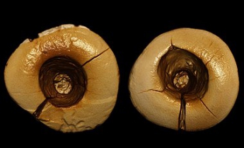 Ученые нашли следы пломбы в зубах возрастом около 13 тыс лет