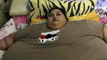 Самая тяжелая женщина в мире со скандалом похудела на 330 кг (фото)