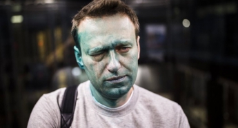 Навальному зробили операцію в Іспанії
