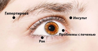 8 сигналов, которые подают ваши глаза, предупреждая о проблемах в организме
