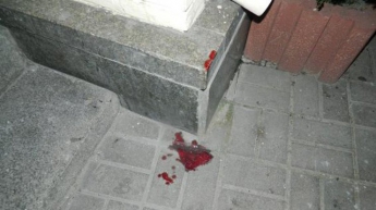 В Киеве подростки жестоко избили прохожего из-за iPhone