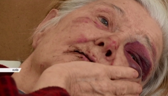 Пытали и рвали рот: в Киеве произошло зверское нападение на пенсионерку