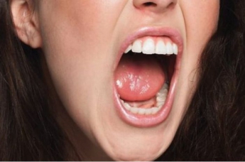 Удалит бактерии во рту, отбелит зубы, устранит неприятный запах: всего несколько капель этого препарата