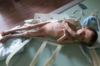 В Кировоградской области родители заморили голодом 4-летнего сына