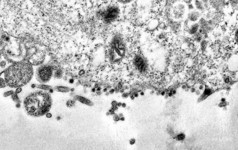 Сделаны фото атаки клеток COVID-19 под микроскопом (фото)