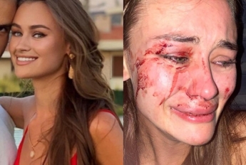 Украина обратилась к властям Турции из-за избиения модели Дарьи Кирилюк на пляже