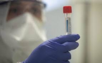 Хорошие новости: в Мелитополе нет новых случаев коронавируса