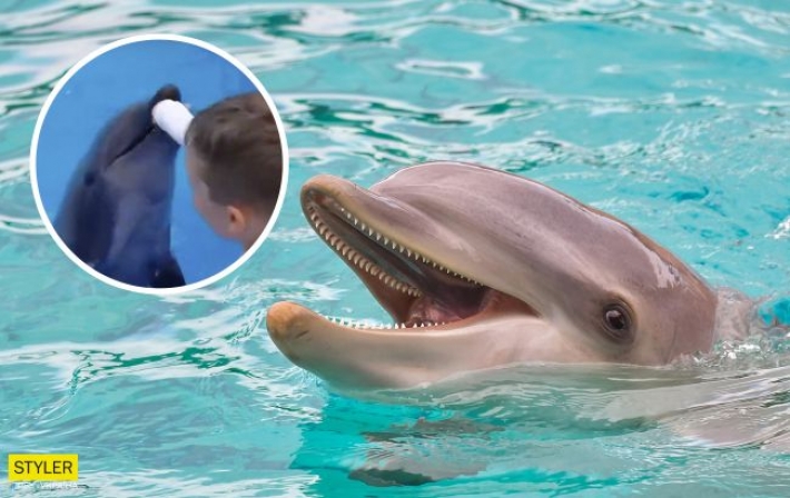 В Одессе дельфин укусил маленького ребенка: пришлось накладывать швы (видео)