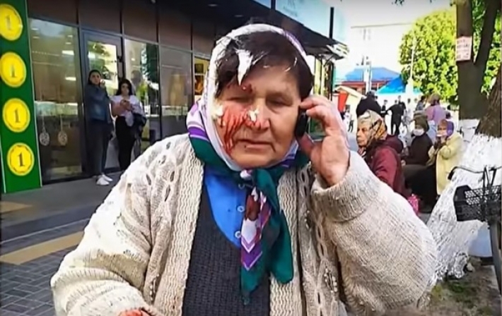 На Ровенщине пенсионерке разбили голову банкой сметаны (видео)