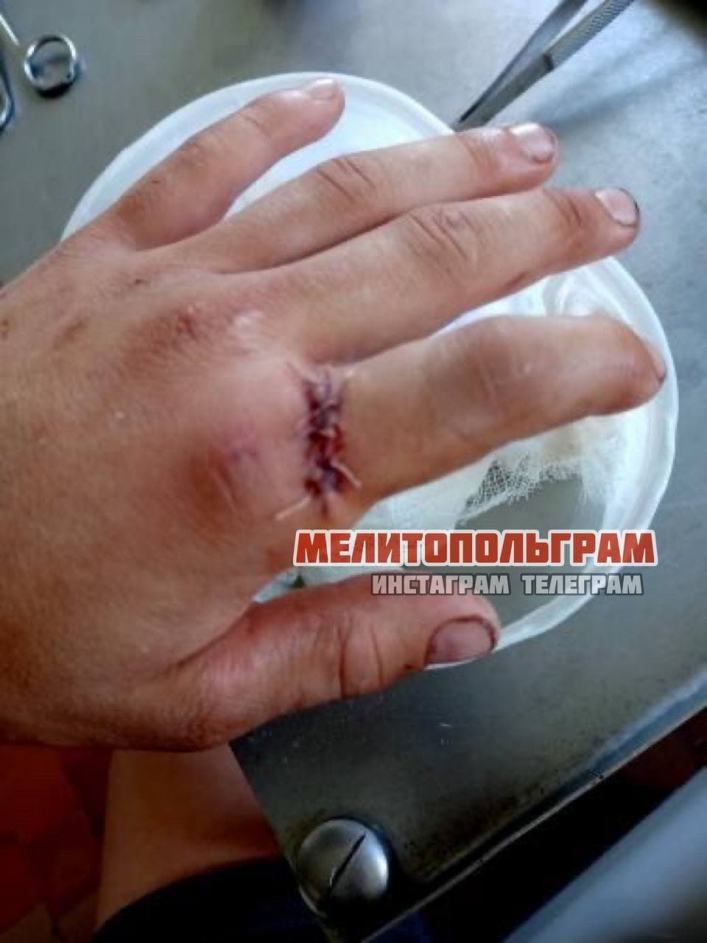 В Мелитополе в больнице отказали в помощи раненному мужчине (фото)
