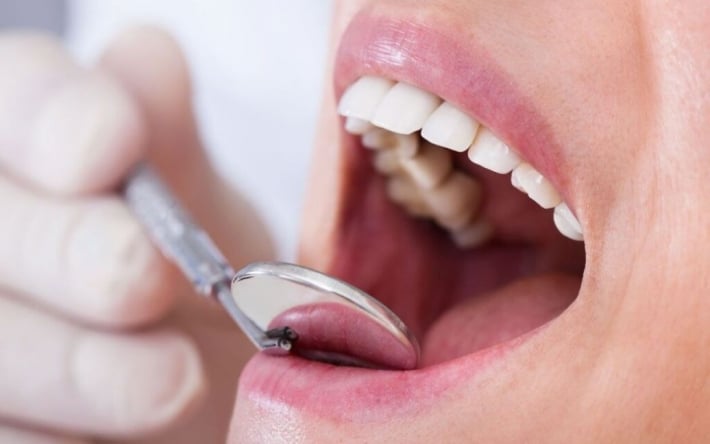 Ви про це точно не знали: якщо є проблеми з кишківником, можуть випадати зуби