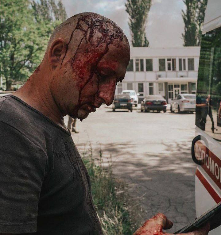 В следствии удара по Запорожью ранены 14 человек (фото2)