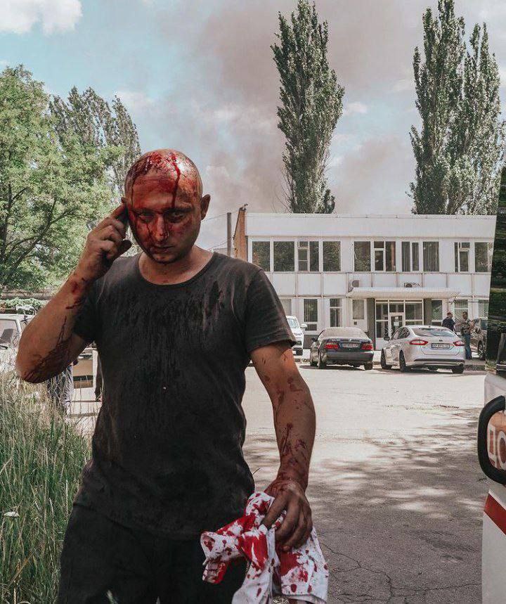 В следствии удара по Запорожью ранены 14 человек (фото1)