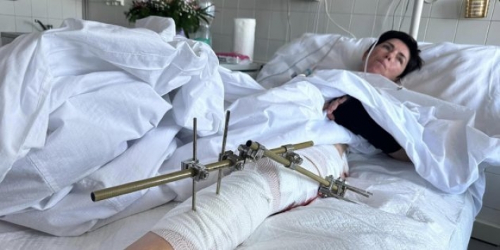 Журналістка розповіла про своє поранення під час ракетного удару по Запоріжжю