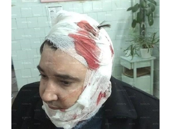 В Николаеве в результате столкновений и перестрелок пострадали 10 человек (видео)