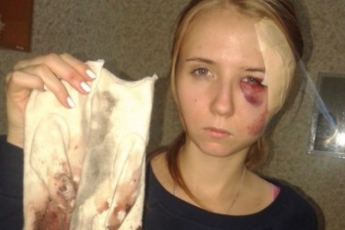 В Одессе бизнесмен на внедорожнике сбил на "зебре" девушку (ВИДЕО)