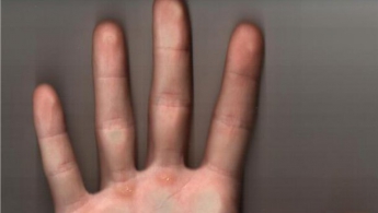 Склонность к измене можно определить по длине пальцев, — психологи