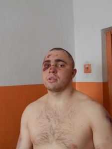 Правозащитники показали фото избитого в колонии заключенного (фото)