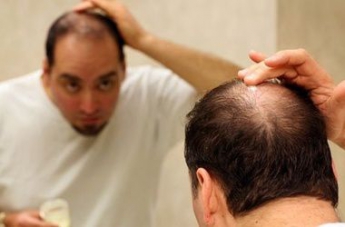 Кариес и выпадение волос вызваны одной и той же причиной – исследование