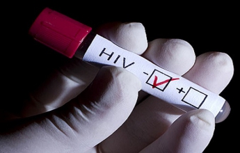 Во Франции зафиксировали случай долгосрочной ремиссии без лечения у пациента с ВИЧ