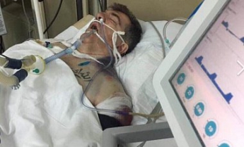 Покушение на Осмаева: опубликовано фото киллера из больницы