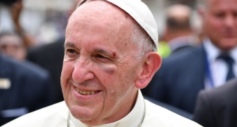 Папа Римский Франциск в Колумбии получил травму головы