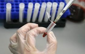 В Запорожье еще трое жителей заболели гепатитом