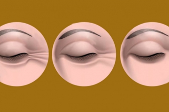 Как удалить морщины у внешнего угла ваших глаз: 6 простых советов