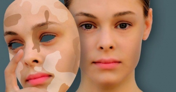Известный дерматолог показал, как вывести коричневые пятна на коже лица и тела