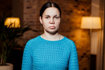 Женщине из Запорожья вернут красоту на украинском проекте