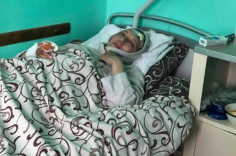 В Киеве женщину избили молотком: спасла шапка. ФОТО