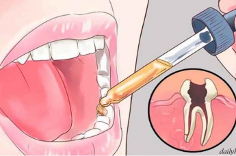 Стоматолог не расскажет: есть целых 12 способов снять зубную боль
