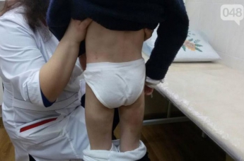 Под Одессой школьная медсестра уличила мужчину в избиении 7-летней дочери