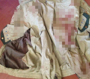 Житель Запорожской области совершил разбой, сняв порванную куртку с жертвы (Фото)