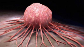Возникновения рака: ученые назвали неожиданную причину