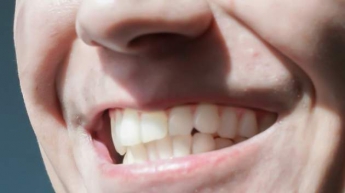 В Индии продавец канцтоваров проглотил вставные зубы