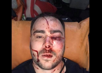 В полиции прокомментировали избиение запорожского активиста "Автоевросилы"