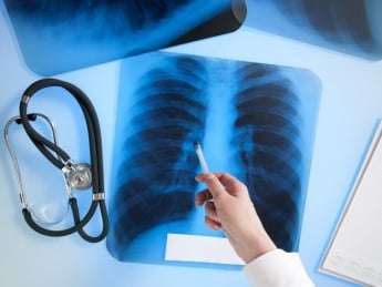 В Мелитополе школьница заболела туберкулезом