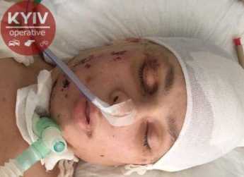 В Киеве не могут опознать найденную без сознания молодую девушку