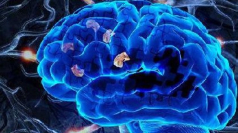 Ученые обнаружили новый симптом болезни Альцгеймера