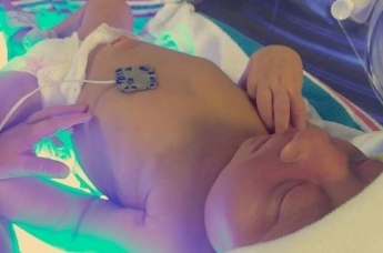 Готовятся отдать на органы: женщина сознательно родила больного ребенка с одной целью