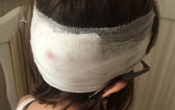 Громкий скандал в столичной школе: девочке с разбитой головой не вызвали «скорую»