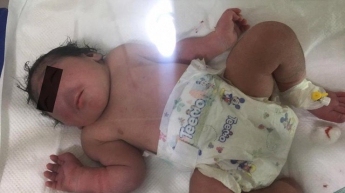 В Ираке родился ребенок без носа (фото)