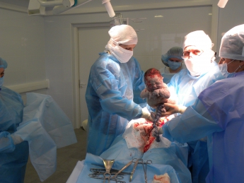 Чудо рождения. В новой операционной роддома родился первый малыш (фото)