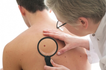 Где в Мелитополе можно пройти бесплатное обследование на рак кожи