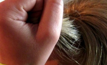 Жительнице Запорожья вырвали волосы за замечание о непристойном поведении (ФОТО)