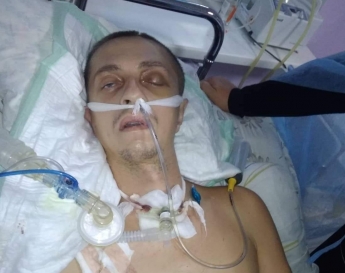 Родичам Миколи, якому проломили голову, запорізькі медики сказали, що будуть відключати від апаратів