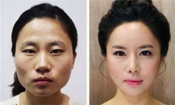 Пластическая операция в подарок и балетки в мороз - жительница Мелитополя рассказала о причудах Южной Кореи